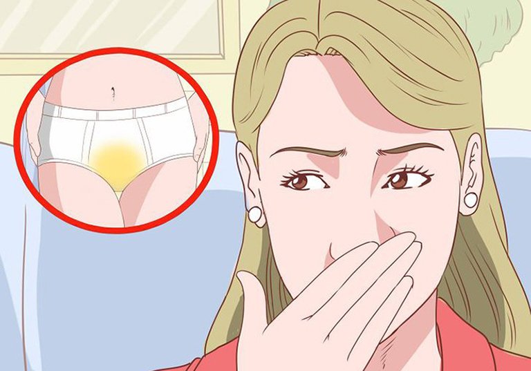 Huyết trắng ra nhiều kèm mùi hôi là do bệnh lý
