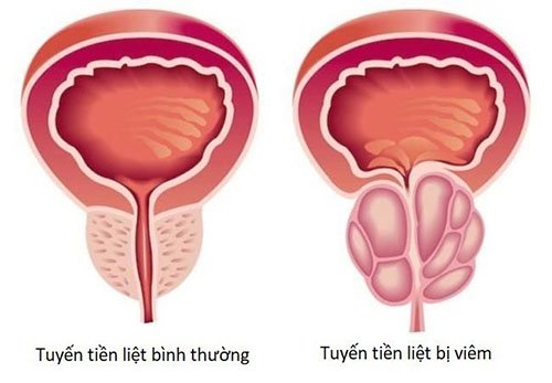 Tinh trùng có vị đắng là như thế nào? Tại sao có vị đắng?
